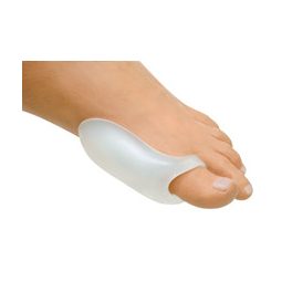 Bütyök (hallux valgus)